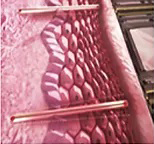 Electrodes inserted into dermal tissue