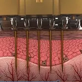 Selective coagulation on basement membrane blood vessel