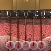 Selective coagulation on basement membrane blood vessel