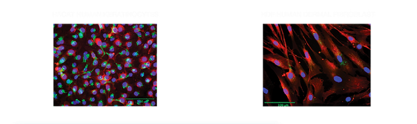 Exosomes cellular uptake